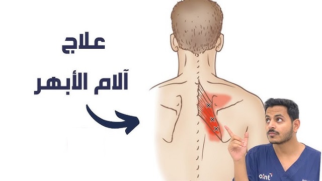 تجاربكم مع علاج الابهر