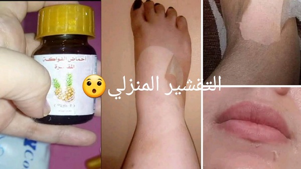 تجربتي مع مقشر احماض الفواكه