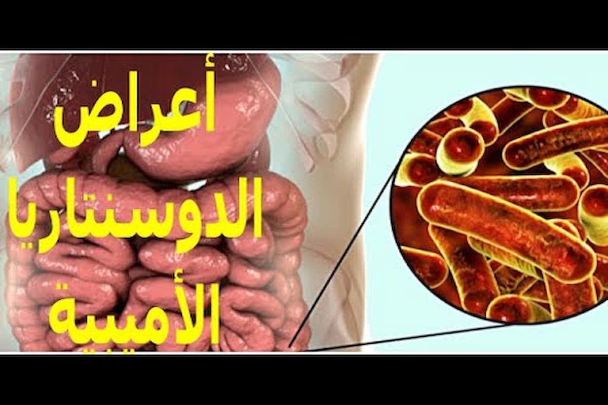 تجربتي مع علاج الدوسنتاريا الأميبية المزمنة بالأدوية 1 علاج الدوسنتاريا الأميبية المزمنة بالأدوية