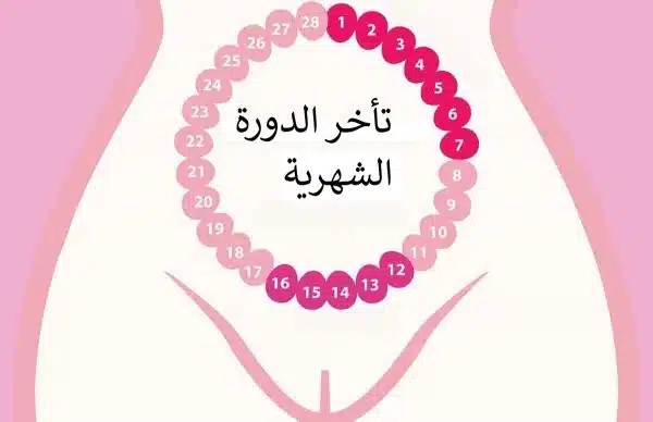 ما سبب تاخر الدورة الشهرية للعزباء وما هي الحالات التي يجب فيها استشارة الطبيب؟ 1 سبب تاخر الدورة الشهرية للعزباء