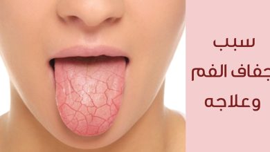 سبب جفاف الحلق رغم شرب الماء