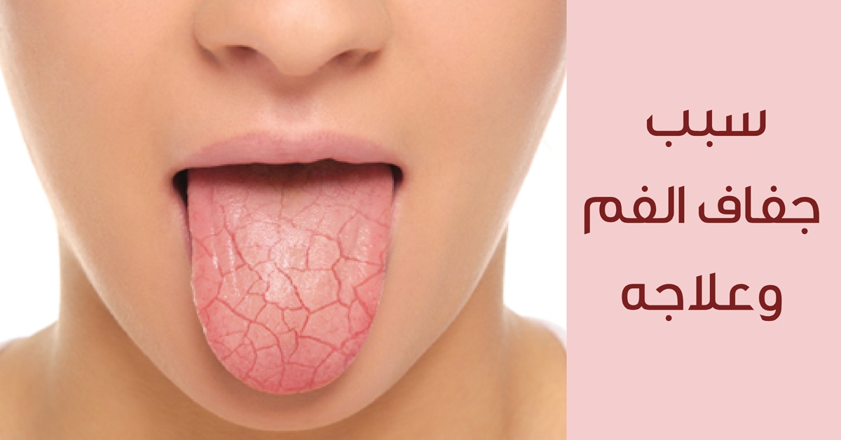 سبب جفاف الحلق رغم شرب الماء وأعراض المرض وطريقة العلاج الصحيحة 1 سبب جفاف الحلق رغم شرب الماء