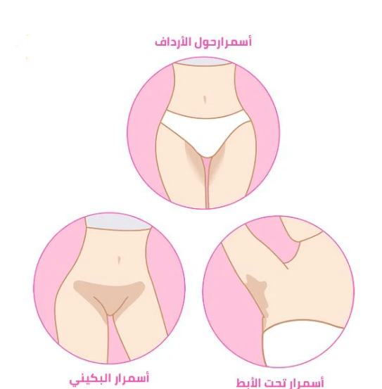 كيفية تبييض المناطق الحساسة طبيعيا بأسرع وقت 1 المناطق الحساسة